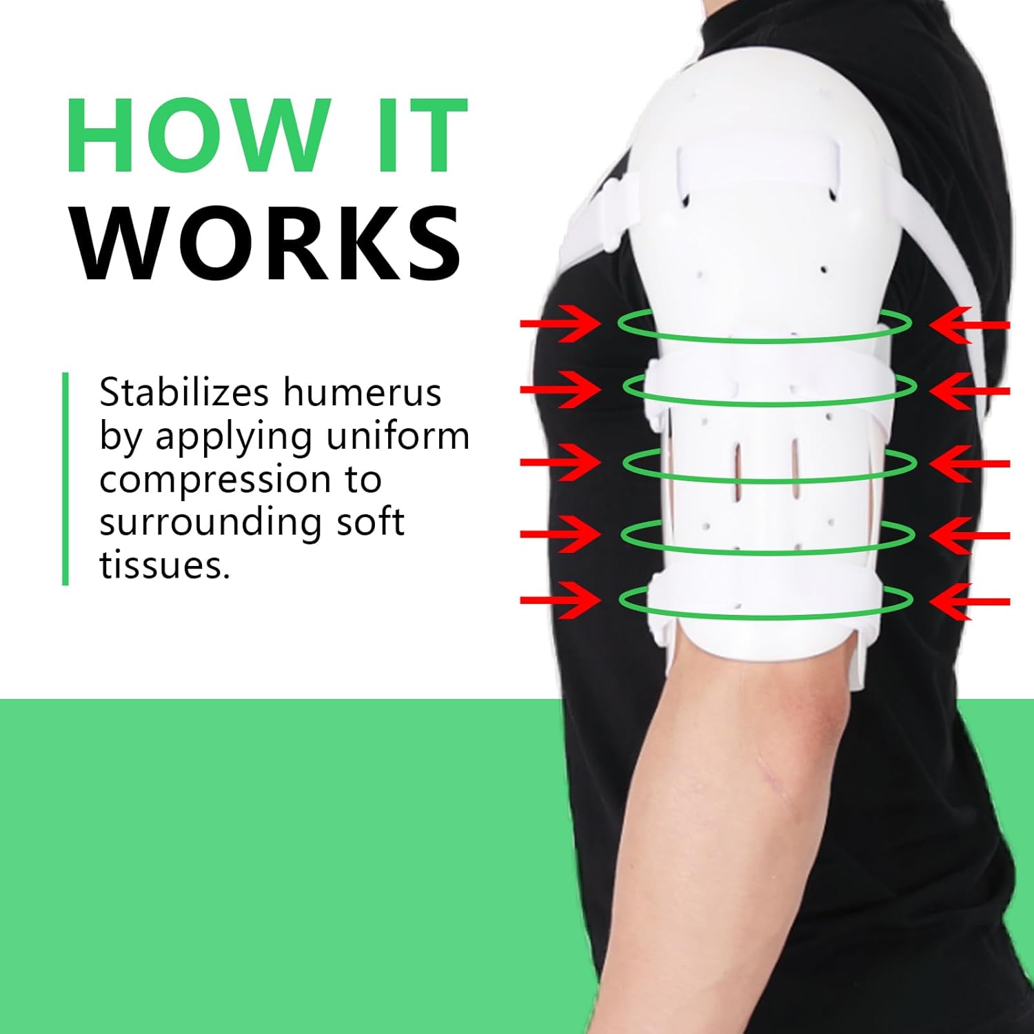 Sarmiento Brace - Humeral Shaft Fracture Splint Cast