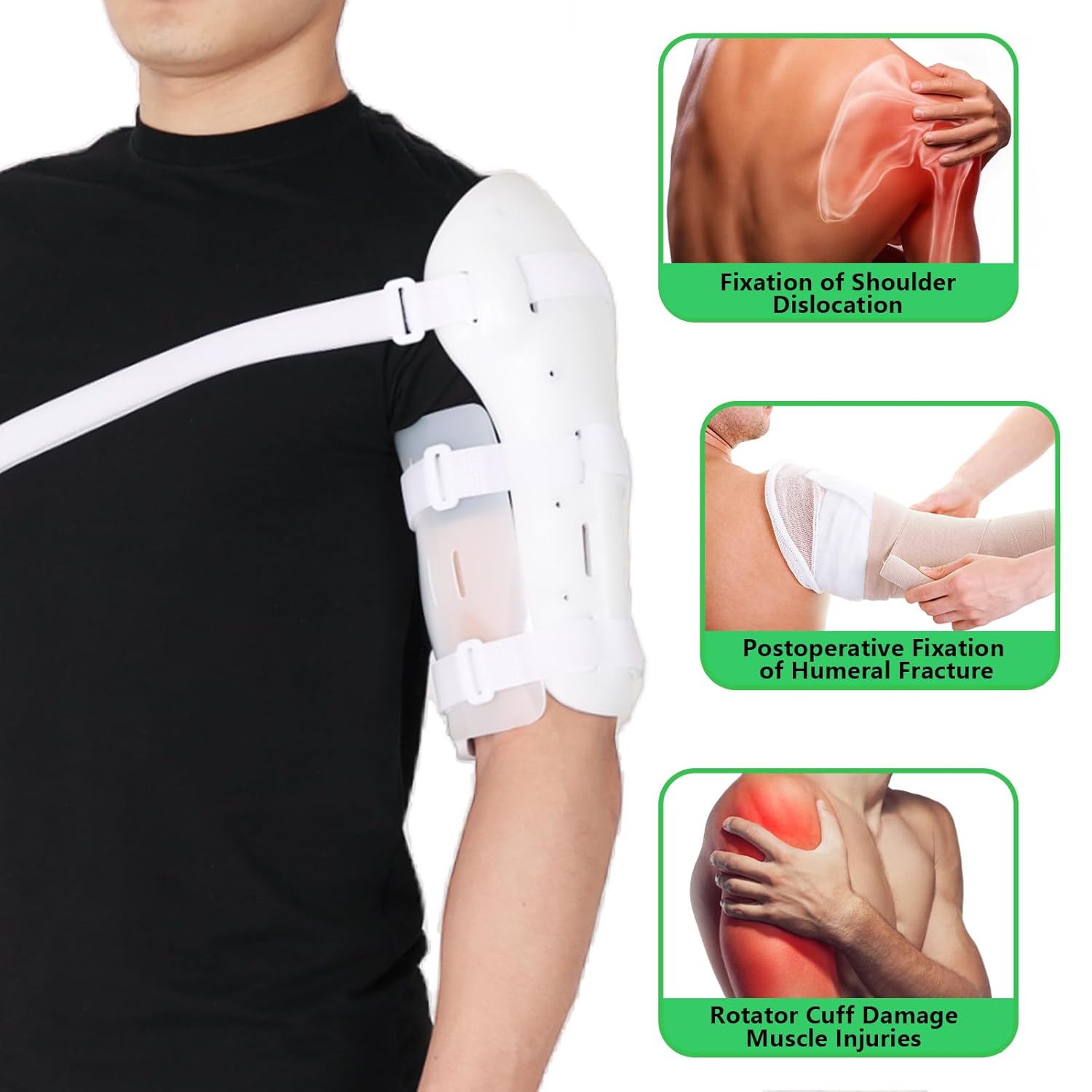 Sarmiento Brace - Humeral Shaft Fracture Splint Cast