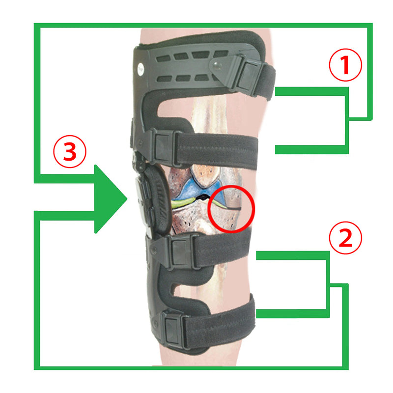 Osteoarthritis Unloader Knee Brace