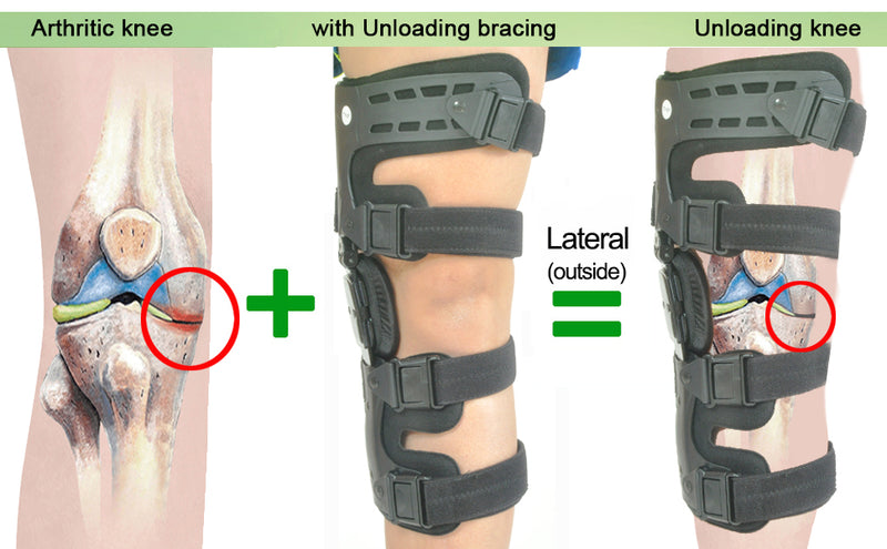 Osteoarthritis Unloader Knee Brace