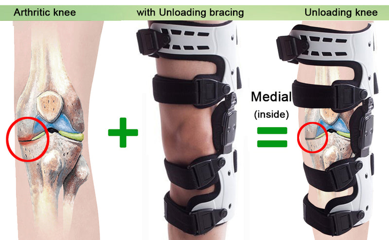 .com: OA Unloader + Knee Brace Undersleeve : Health & Household